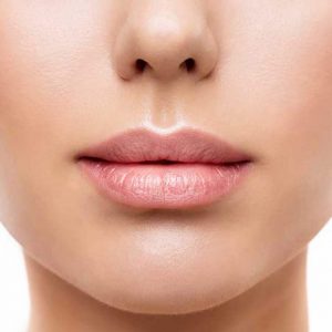 Upper Lip and Chin